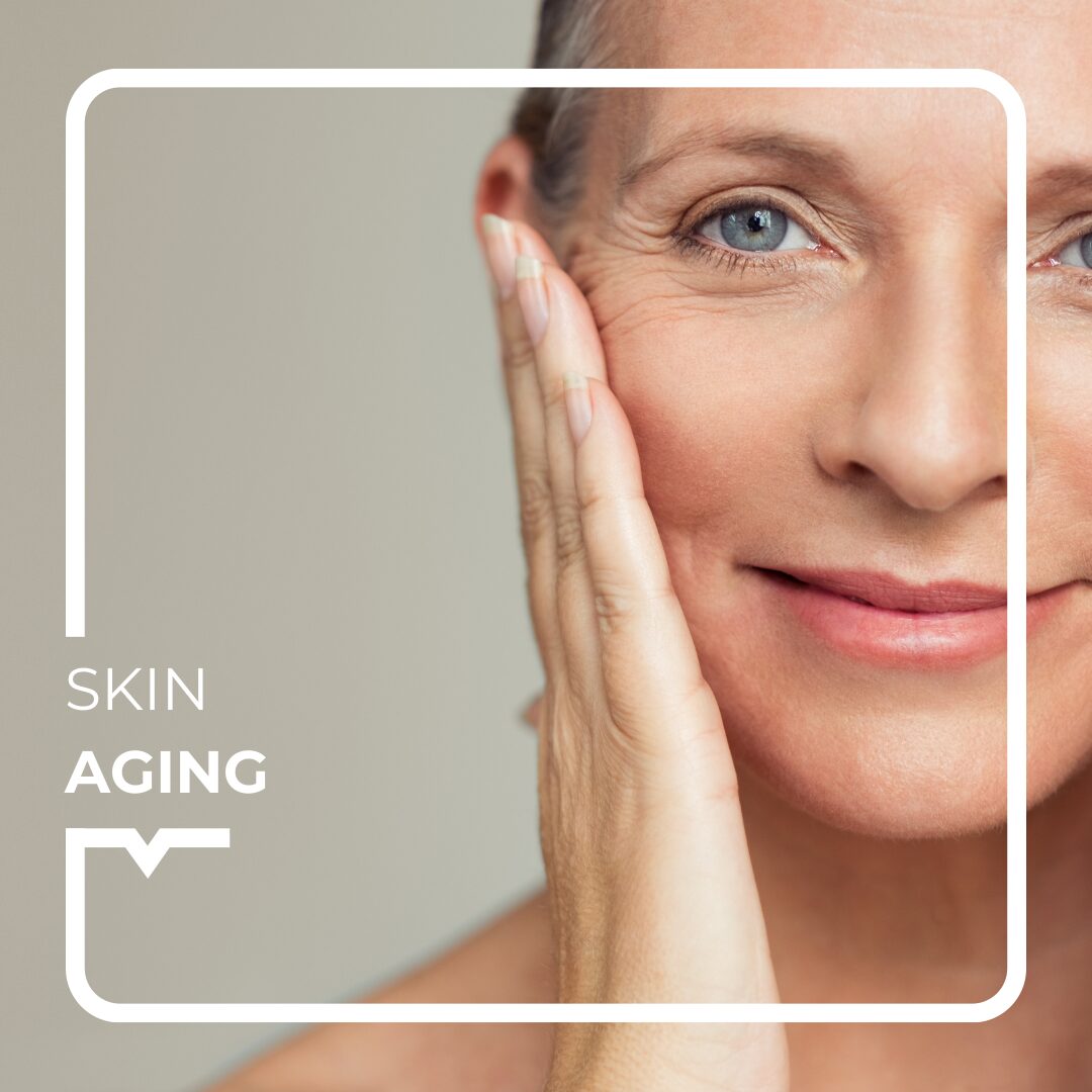 Skin aging - Alegria Medical Centre