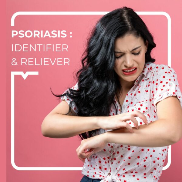 Psoriasis: identifier et soulager