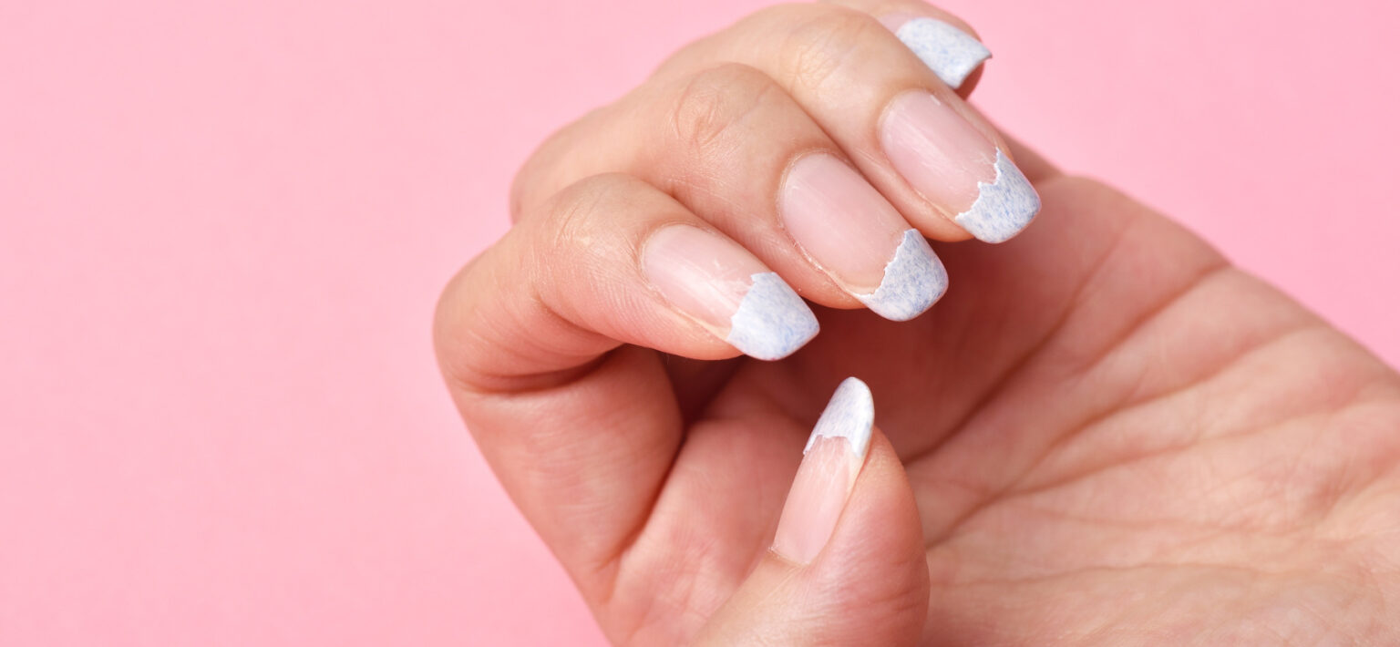 Ongles et cheveux : quelles maladies les affectent ? - alegria medical